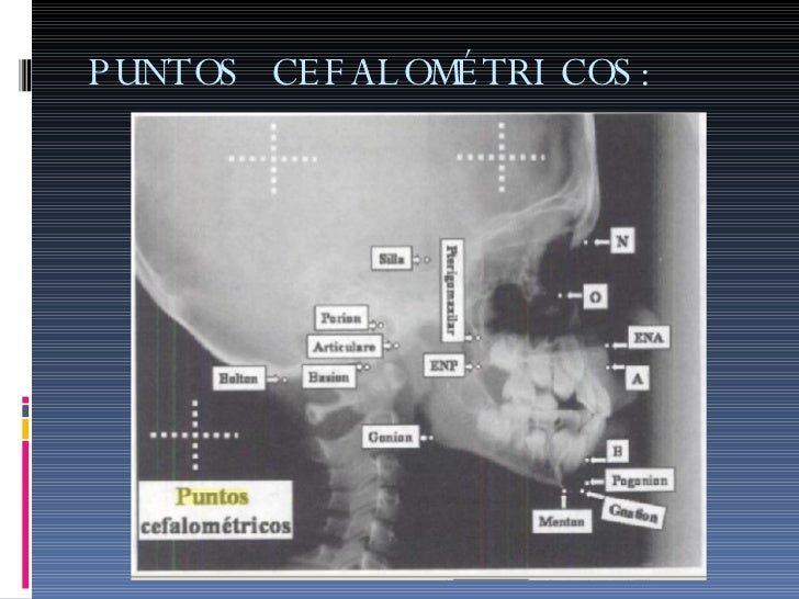 Puntos Cefalometricos Epub